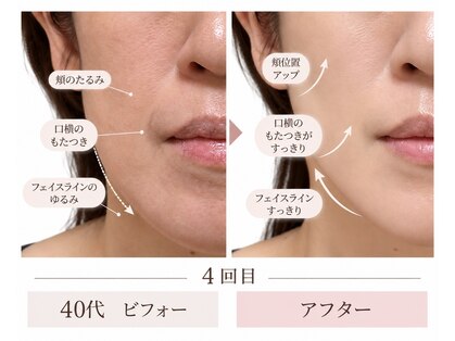 リアン(Lien)の写真