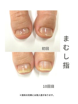 最強ネイルケア