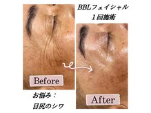 サロン ド ボーテ ラニ 戸塚店(LANI)の雰囲気（BBLフェイシャルは1回でも効果を実感！大切な日の前にオススメ！）