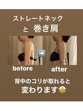 サロン ド プリヴェ(Salon de PRIVE)/割と自覚のない背中の張りとコリ