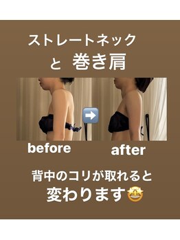 サロン ド プリヴェ(Salon de PRIVE)/割と自覚のない背中の張りとコリ