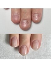 ジル(JiLL)/【自爪育成】