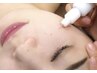 シミケア３箇所＋フェイシャル　￥8，000