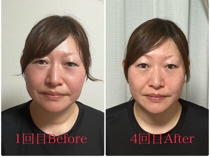 シルフィードの写真