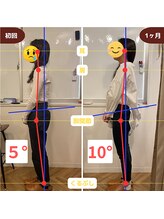 ふらっと/20代前半/大学生 猫背・スマホ首