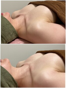 サロン ド アヴニール(SALON de AVENIR)/バスト周りに脂肪少ない方に!