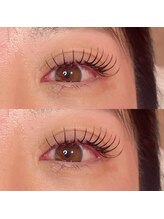 アレーヌ 中津店(Allene)/マツエク/まつパ/パリジェンヌ