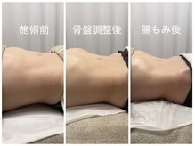 カナロア(Kanaloa)/腸もみ×骨盤調整！痩身/リンパ