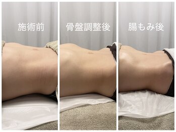 カナロア(Kanaloa)/腸もみ×骨盤調整！痩身/リンパ