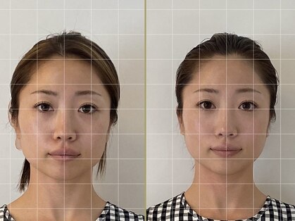 ビノス(Bnos)の写真