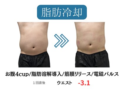 ウナ 福岡店(UNA)の写真