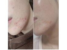 リセットラボ 本店(Reset Lab)/ルヴィでこの結果☆☆