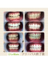 ルブラン 奈良店(Le Blanc)/ホワイトニングは今や当たり前