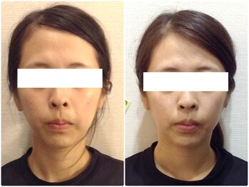 美容整体ウェリナ あま甚目寺院/小顔矯正/骨盤矯正/美脚サロン