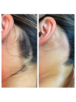 サロンアンドスクール ローズマリー (Salon&School Rosemary)/うなじの毛のお手入れ　¥4400