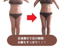 ニュートラル 池袋店(NEUTRAL)/施術結果【痩身/エステ/筋膜】