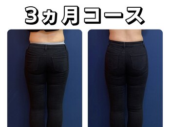 久留米スポーツ整骨院 整体院/エステ◆痩身インディバエステ