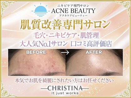 アクネビューティー 恵比寿代官山(ACNE BEAUTY)の写真