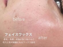 ワクシー 恵比寿店(WAXYYY.)/肌が綺麗になるフェイスワックス