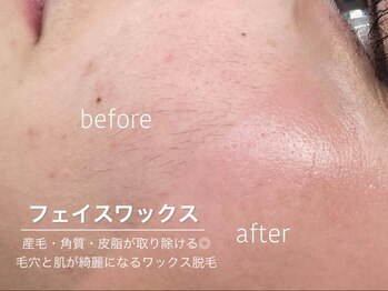 ワクシー 恵比寿店(WAXYYY.)/肌が綺麗になるフェイスワックス