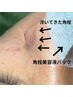 【毛穴黒詰り/小鼻の角栓/ざらつきを改善◎】鼻すっきり毛穴コース【60分】