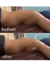 オーシャンブルーム 目黒(OceanBloom)/自律神経ハイパーナイフ