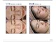 エピラックス(epilax)の写真