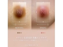 ルミナス ケア(Luminous Care)の雰囲気（ルメラ/バストトップ・Before/After）