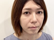 トミー(Tommy)/まつ毛パーマ