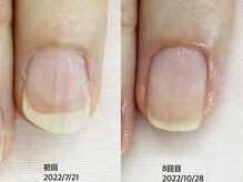 キアラネイル(Chiala nail)/自爪育成
