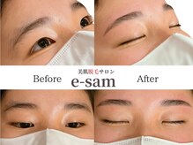 イーサム(e-sam)/美眉WAX脱毛