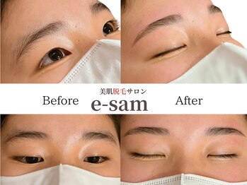 イーサム(e-sam)/美眉WAX脱毛