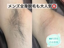 リリーライオン(Lily Lion)の雰囲気（来店前自己処理不要のワックス×光照射のダブル脱毛☆都度払い）