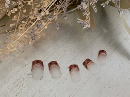 べっこうフレンチ