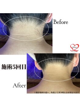 オリオンドットエスツー(Orion.S2)/【Before→After】