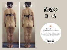 エスエスカイロビューティー(SSCHIRO beauty)/美骨ボディ1部位〔美脚〕直近BA