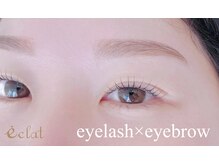 エクラ 東武練馬店(eclat)/セットクーポンでお得に