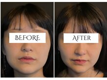 クク 赤坂 天神(99 KUKU)/【小顔】