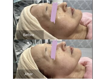 じゅえる/→続きシミケアとシワたるみケア