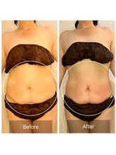 ウィズ ユー ビューティ(with U beauty)/一目瞭然