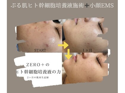 ゼロプラス(ZERO+)の写真