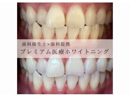 ワールドビューティー(World Beauty)の写真