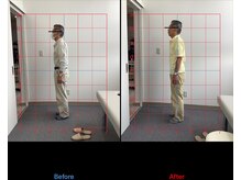 リード整骨院(LEAD整骨院)/姿勢改善/猫背/反り腰/骨盤矯正