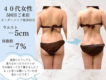 エクストリミティ 国立店(EXTREMITY)の雰囲気（お忙しい女性必見◎痩身も小顔も当店にお任せください♪）