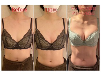 チュリップ(Tulipe)/育乳ビフォーアフター