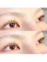 アトモス サニーテラス(Atmos sunny terrace)/パリジェンヌ　韓国ロッド