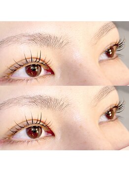 アトモス サニーテラス(Atmos sunny terrace)/パリジェンヌ　韓国ロッド