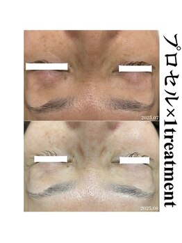 ヒルナム(Heal Nam)/プロセルセラピーズ~フェイス~