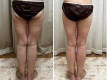 結果重視◎ぽっこりお腹、下半身痩せ、二の腕、お任せ下さい♪