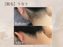 セリーナ 伊賀上野店(CELINA)/【うなじ】脱毛